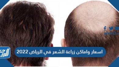 اسعار واماكن زراعة الشعر في الرياض 2022