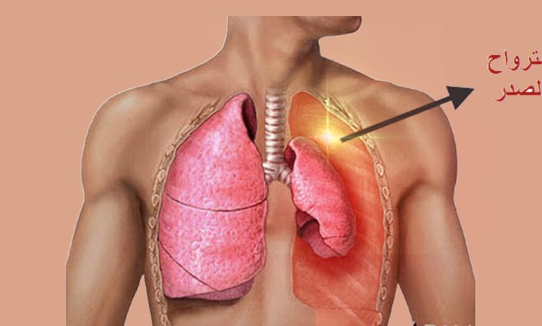 ماهو إسترواح الصدر الأعراض الأسباب وطرق العلاج Pneumothorax